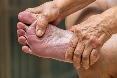 How Aging Can Seriously Affect the Feet