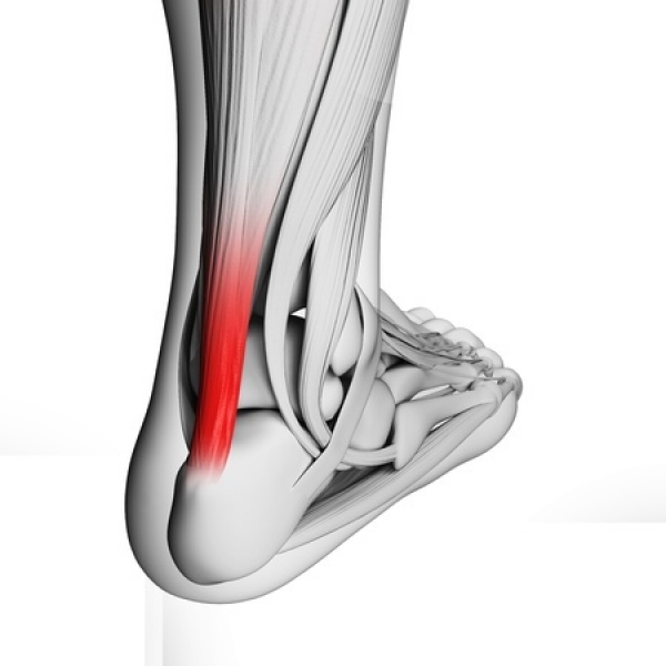 What’s Behind Tendonitis?