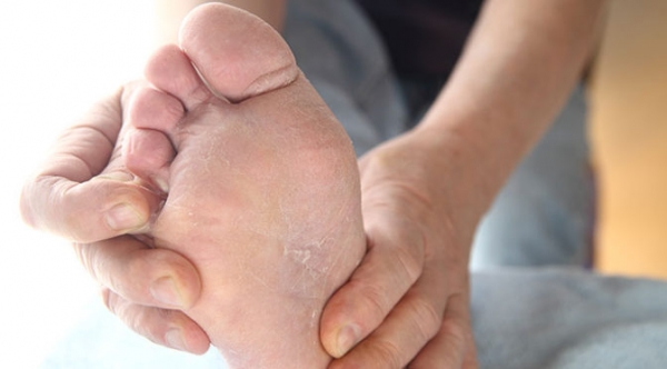 Potential Causes of Itchy Feet