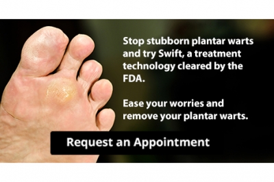 Stop Stubborn Plantar Warts with Swift