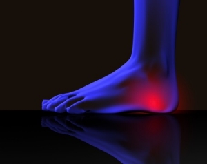 3 Common Causes of Heel Pain