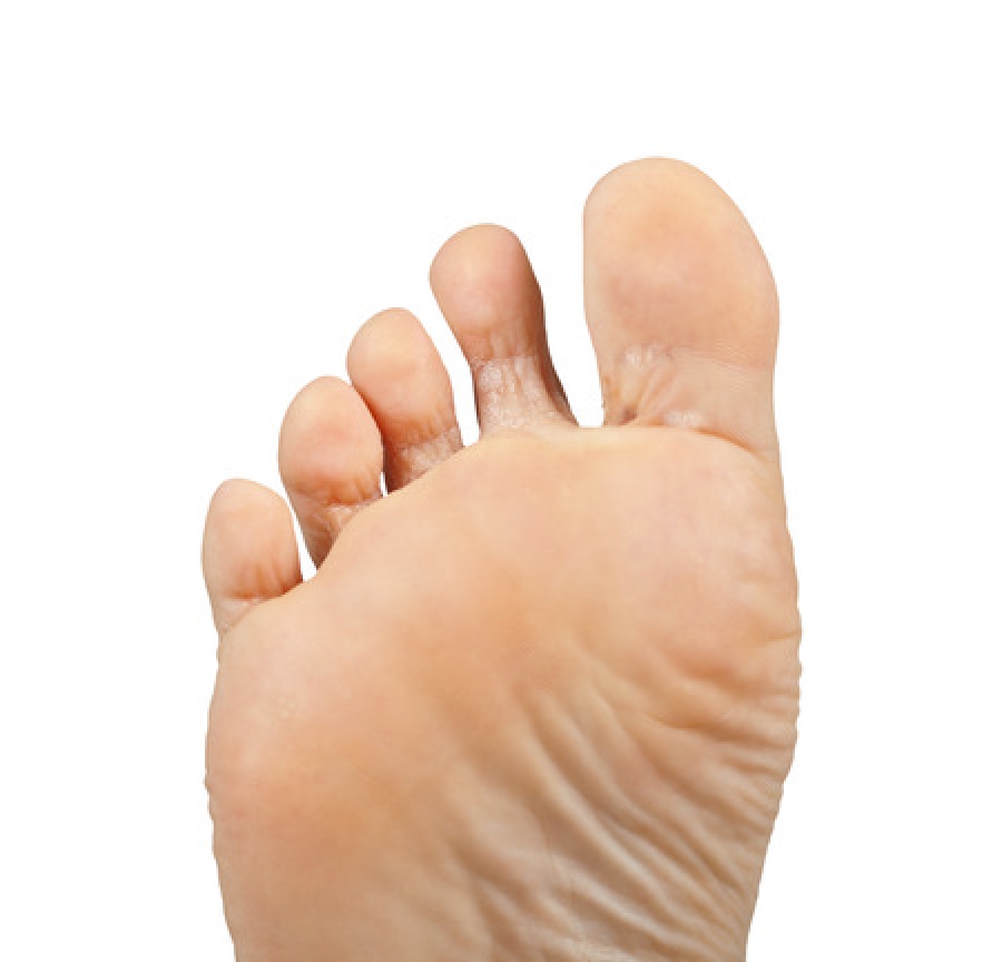 Learn How to Identify and Address Four Major Foot Problems | Nailpro
