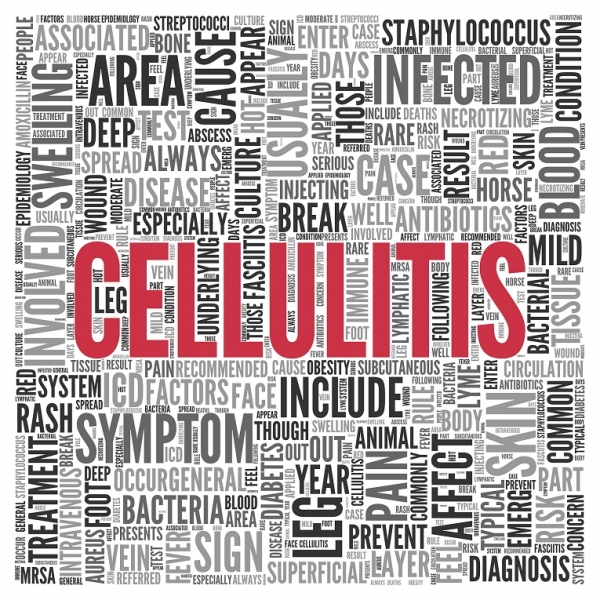 What is Cellulitis