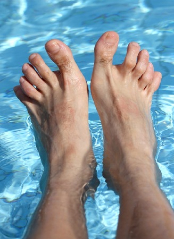 Myths about Hammertoes