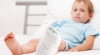 What you Need to do When you Have a Foot Fracture