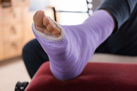 Stress Fractures During Pregnancy