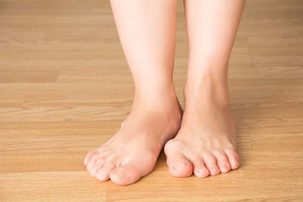 Dealing With Bunions