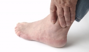 What’s Behind Swollen Feet and Ankles?