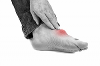 Why You Should Treat Your Gout
